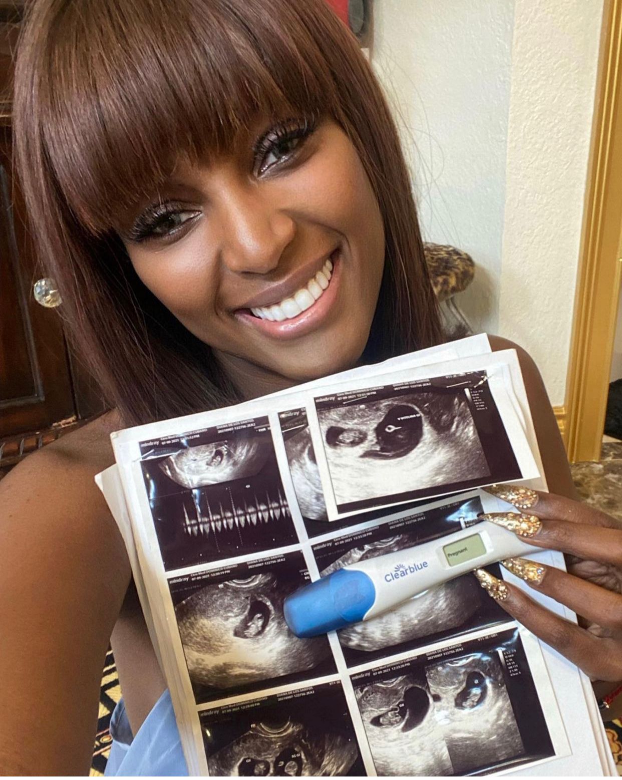 Amara La Negra confiesa estuvo embarazada de trillizos